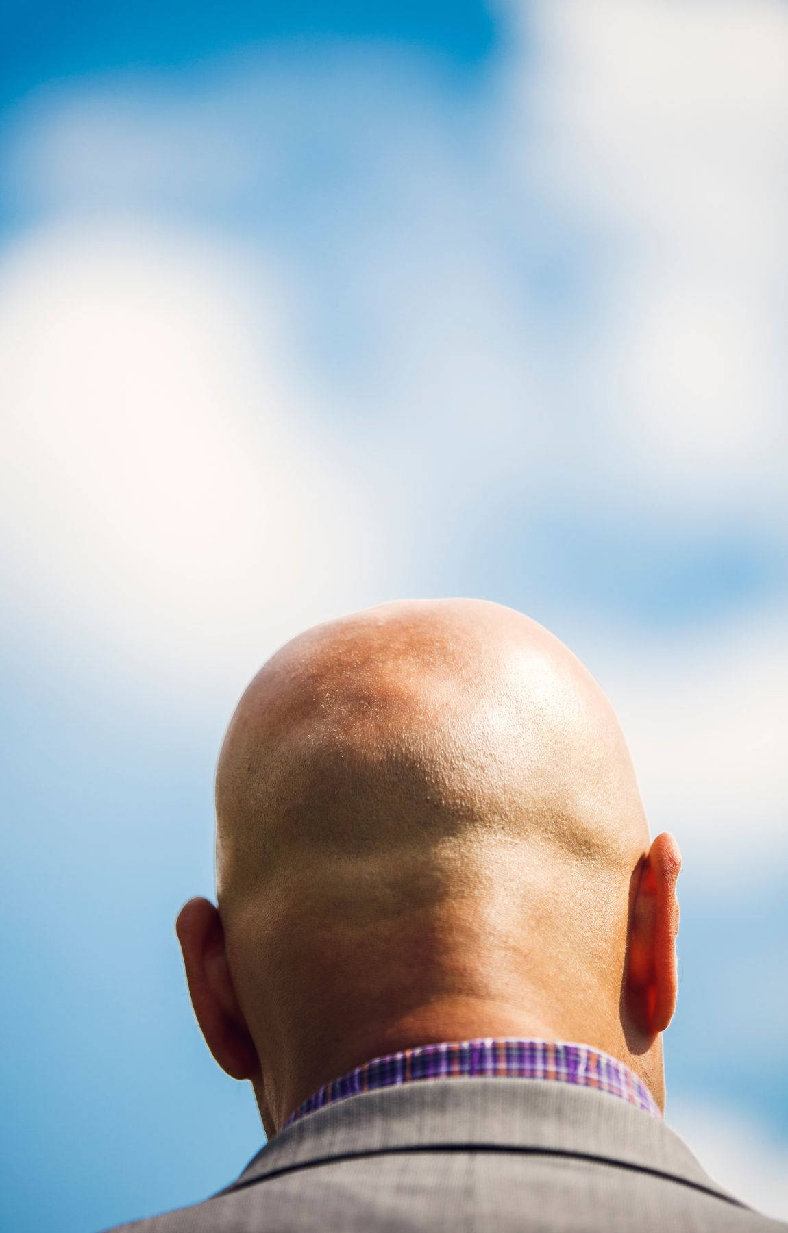 Bald Man And Blue Sky Wallpaper