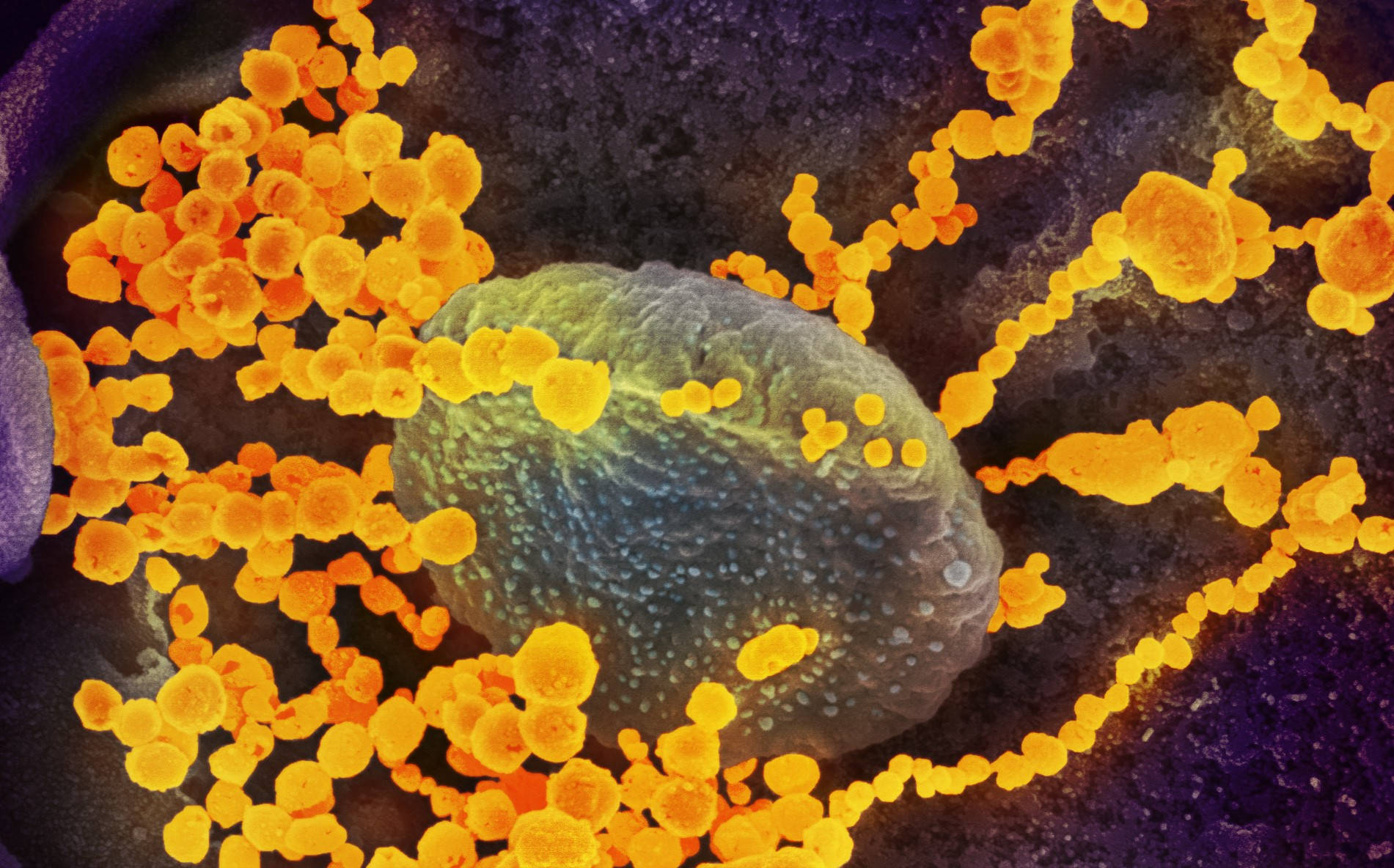 Coronavirus Yellow Particles Wallpaper