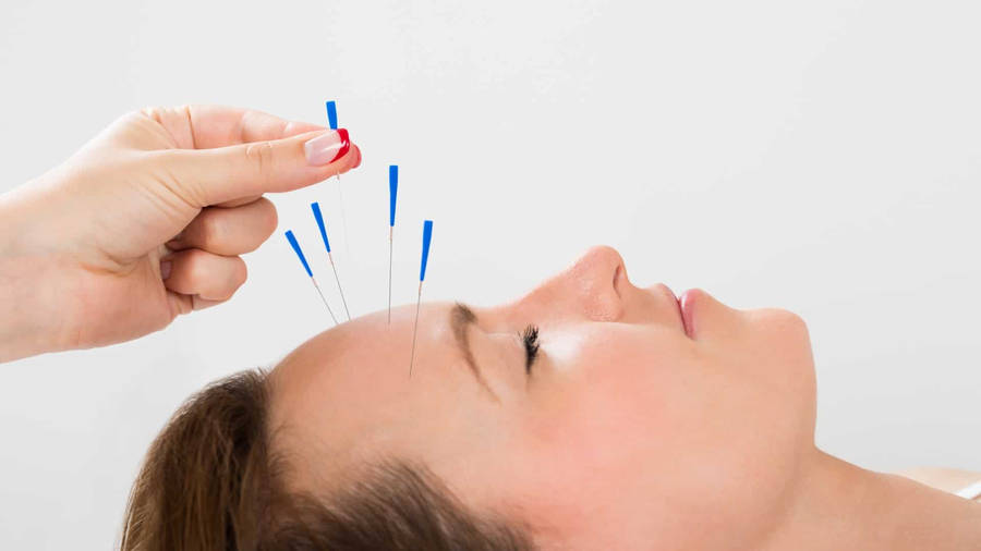 Acupuncturist Head Treatment Wallpaper