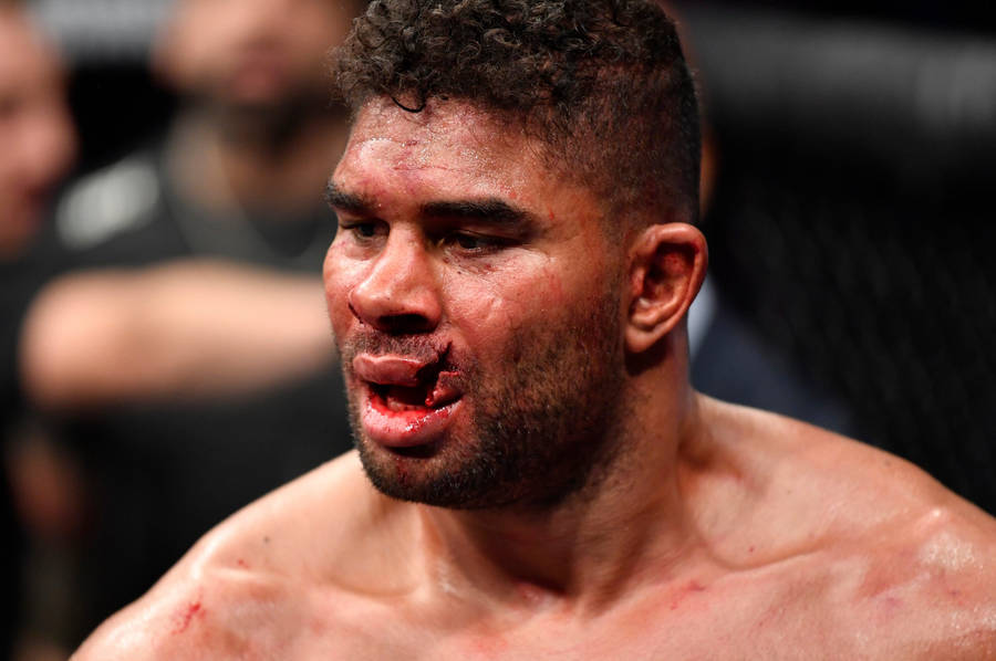 Alistair Overeem With Split Lips Wallpaper