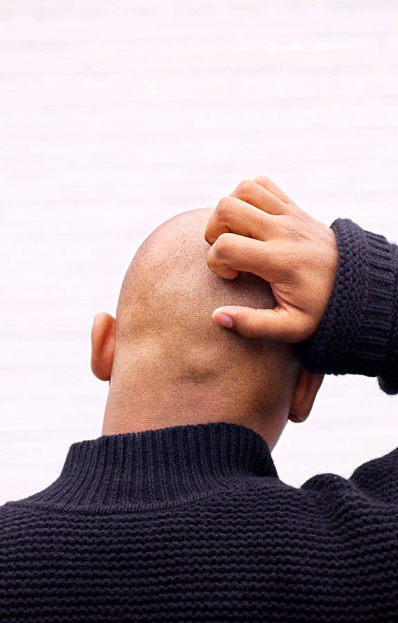 Bald Man Scratching His Head Wallpaper