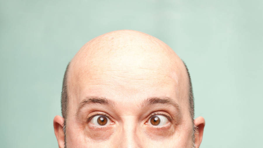 Bald Man With Crossed Eyes Wallpaper