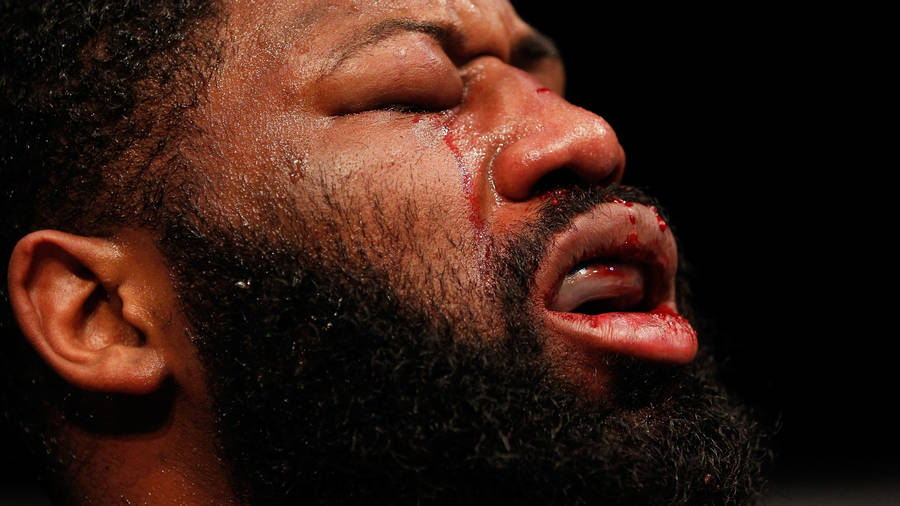 Curtis Blaydes Swollen Eyes Wallpaper