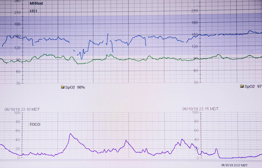 Fetal Heartbeat Monitor Wallpaper