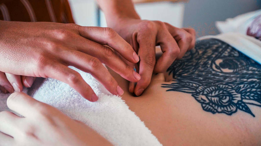 Skilled Acupuncturist Performing Needle Therapy On A Patient's Back Wallpaper