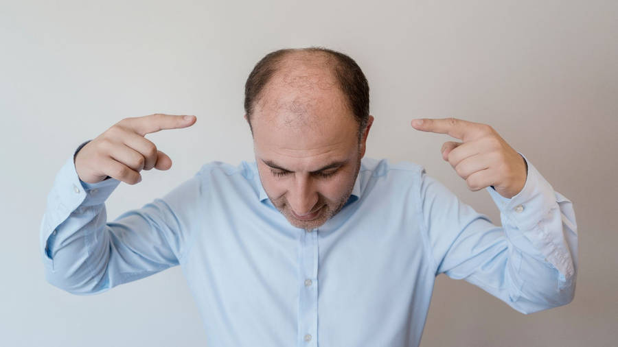 Thoughtful Bald Man Gesturing Towards Head Wallpaper