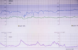 Fetal Heartbeat Monitor Wallpaper